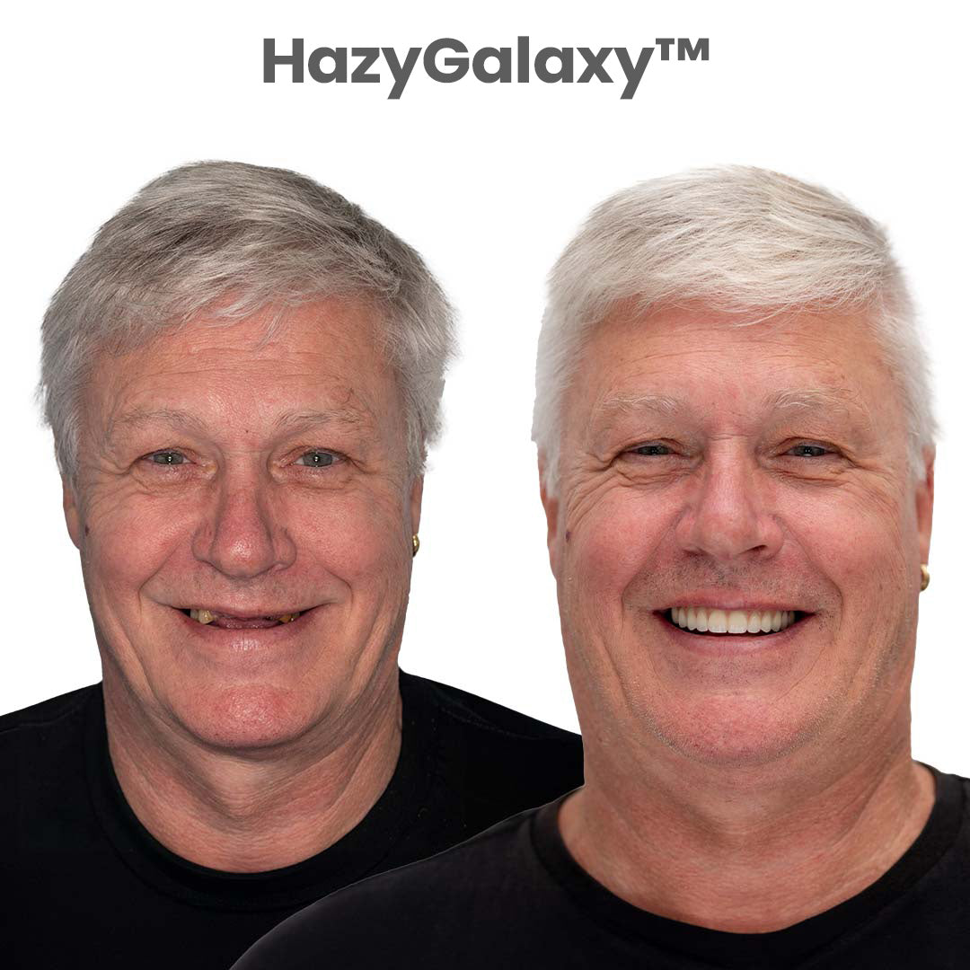 ☀️Summer Sale – Hybrid Hairline Topper-Up to 92% OFF